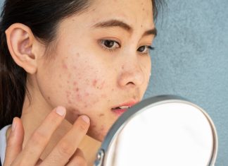 Ciri Tidak Cocok dengan Skincare