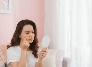 Sederet Makanan yang Pantang Dikonsumsi saat Berjerawat
