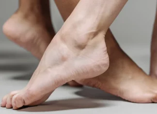 Penyebab Telapak Kaki Pecah-pecah yang Jarang Disadari