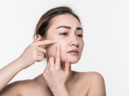 Kenapa Jerawat Muncul Setelah Ganti Skincare? Ini yang Perlu Diperhatikan