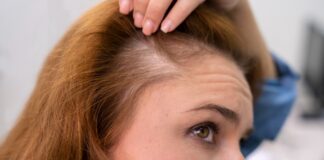 Kenapa Rambut Bisa Berubah Jadi Tipis Seiring Bertambahnya Usia? Ini yang Perlu Kamu Tahu